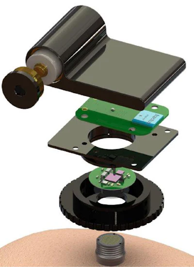 The wireless device enables transmission of full broadband brain signals while consuming a small amount of power. Batteries last for up to 36 hours.