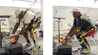 This image shows the study participant performing a squatting activity with different prosthetic devices. When the participant used his daily prosthesis (left picture) he had a limited range of motion and had to bend his back significantly to lift objects off the ground. When using a neural controlled prosthetic ankle (right picture) he was able to voluntarily control his prosthesis ankle joint force and angle and keep a healthy posture while lifting weight from the ground.