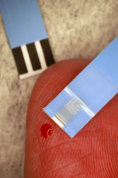 Glucose strips are microfluidic devices that require only a tiny amount of blood to measure blood sugar.
