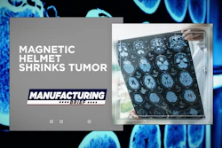 Braintumor