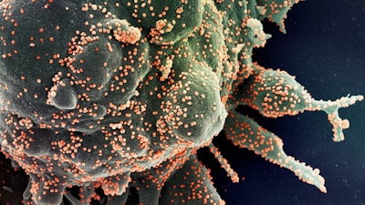 A human cell (greenish blob) is heavily infected with SARS-CoV-2 (orange dots), the virus that causes COVID-19, in this colorized microscope image.