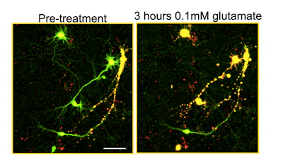 These images show alive neurons colored green and dead neurons colored yellow. To induce death, neurons were treated with an excess of the neurotransmitter glutamate, overstimulating them to the point of irreversible damage.