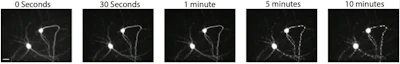 This is a time lapse of what a dying neuron looks like under a microscope. Imagine sifting through hundreds of thousands of images like these by hand!