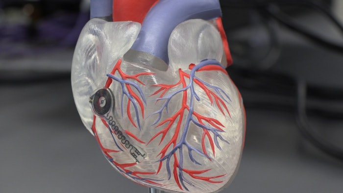 Heart