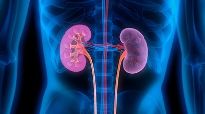 The company will focus on developing a broad suite of novel kidney care products and solutions.