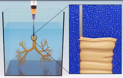 This diagram shows the AMULIT technique printing the bronchi of a lung model within a bath of supporting material. At right is a close-up of the needle depositing layers of silicone to make the tissue.