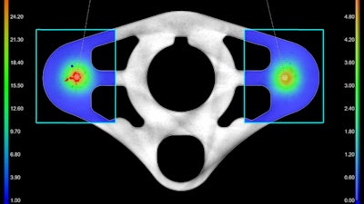 Advanced CT analysis software enables grey-value-based, shape-based, or machine-learning-based segmentation of 3D data. These defined regions of interest (ROIs) can be used to perform further analyses.
