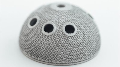 3D printing of metal joint replacements like this acetabular cup for a hip replacement is revolutionizing orthopedic surgery. Making them lighter and stronger could enable a new generation of designs.
