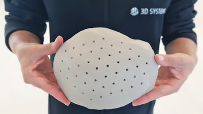 3D Systems' similar PEEK cranial implant was cleared last year by the FDA.