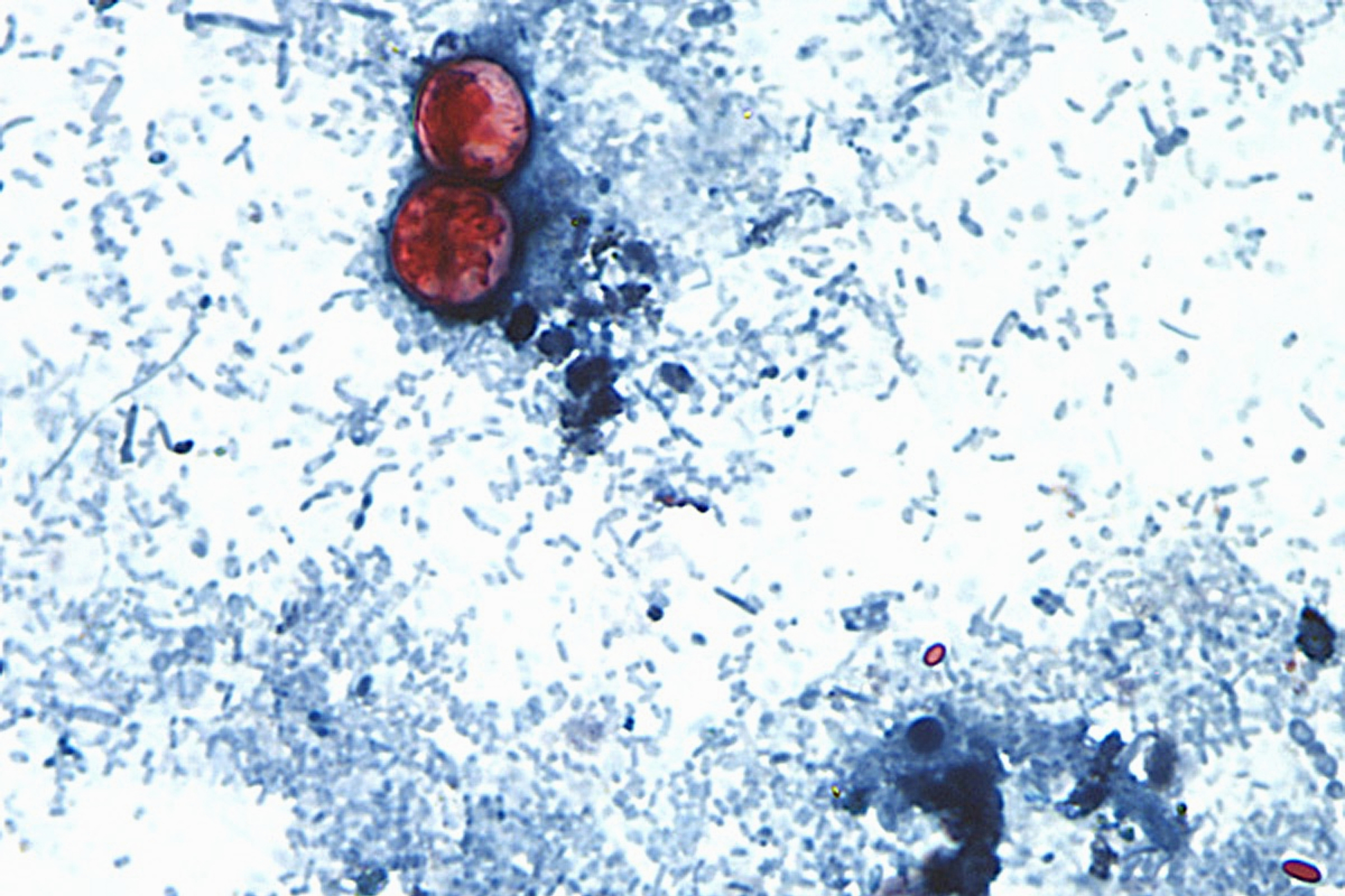 An undated photo taken through a microscope shows Cyclospora cayetanensis oocysts.