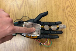 A robotic hand fitted with 3D-printed sensor module developed by the research team from Washington State University. The electronic skin can detect pressure and temperature at a fine level, laying the groundwork for bionic skin that could be used on prosthetics to help amputees and others.